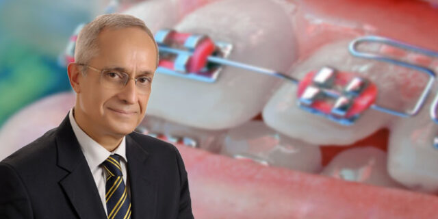 yesil-cay-agiz-ve-dis-sagligini-koruyor-660x330